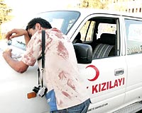 5 K YARALANDI: Kzlay konvoyuna Telaferde yaplan saldrda yaralananlar arasnda gazetecilerde bulunuyordu.