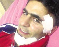 M..nin bak darbeleriyle yaralanan gvenlik grevlisi Mazhar Glerin boazna ve yzne diki atld.